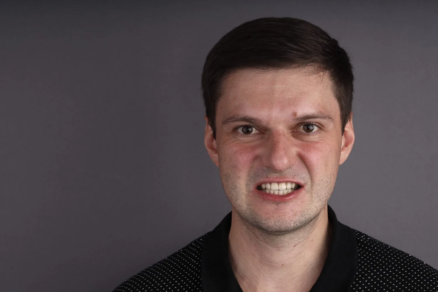 Кейс 02: портрет после эстетического лечения — работа ADN Clinic